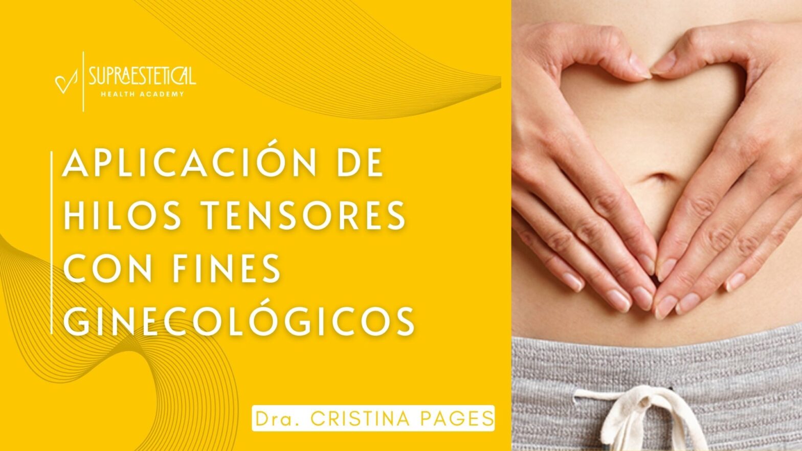 Aplicación de Hilos Tensores con Fines Ginecológicos